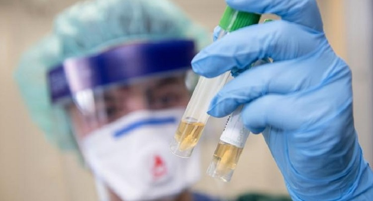 Instructors of the School of Medicine in response to the challenges of the time joined the study of the features of coronavirus infection