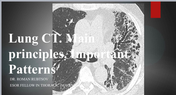 Open lecture by colleagues from Germany. Topic: «CT of the lungs. Basic principles, the most important concepts and patterns»